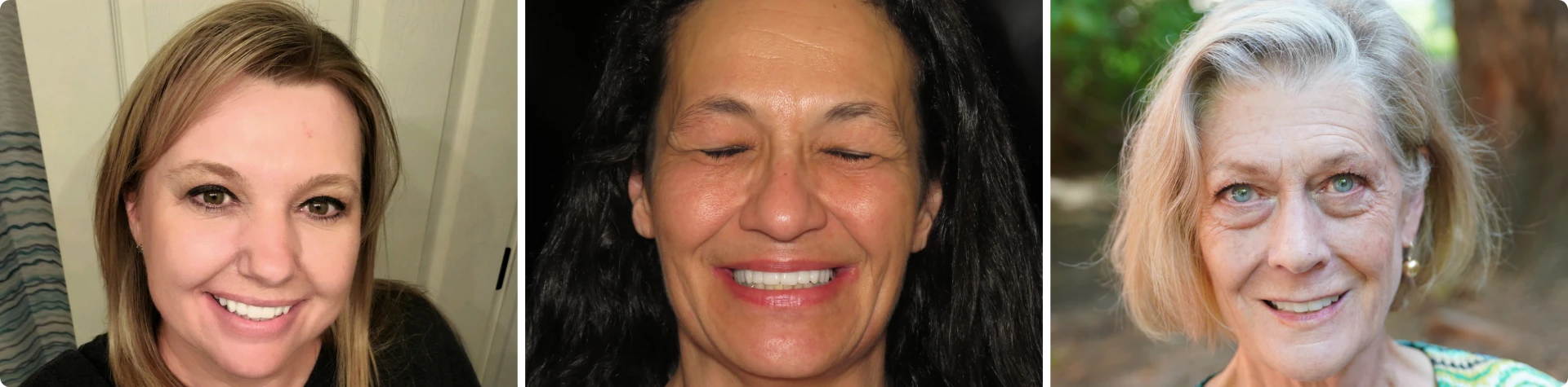 Photos of 3 patients happily smiling with beautiful teeth after getting full mouth dental implants.