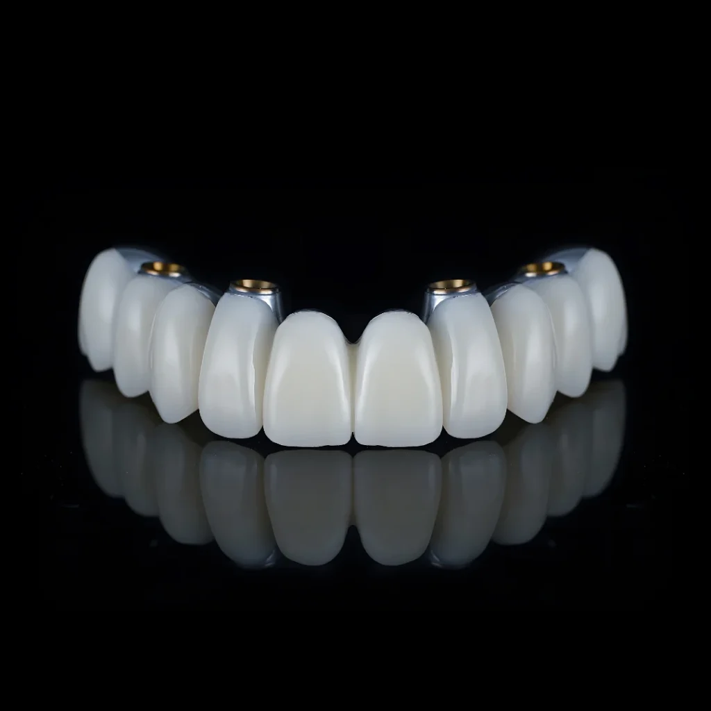 FP1 zirconia teeth for all-on-4 dental implants in Columbus, OH